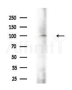 Chromogranin B Antibody - Western blot analysis of extracts from EC304 cells, using Chromogranin B Antibody at 1/1000 dilution.