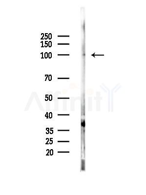 Chromogranin B Antibody - Western blot analysis of lysates from EC304 cells, using Chromogranin B Antibody at 1/1000 dilution.
