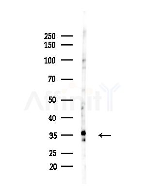 CIP29 Antibody - Western blot analysis of lysates from LoVo cells(heat-shock,45min treatment), using CIP29 Antibody at 1/1000 dilution.