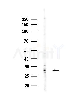 CIP29 Antibody - Western blot analysis of lysates from B16F10-LUC cells(heat-shock,45min treatment), using CIP29 Antibody at 1/1000 dilution.