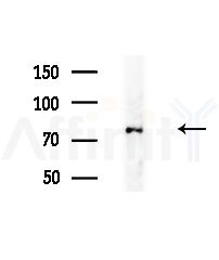 CNKSR3 Antibody - Western blot analysis of extracts from B16F10-LUC cells(UV,30min treatment), using CNKSR3 Antibody at 1/1000 dilution.