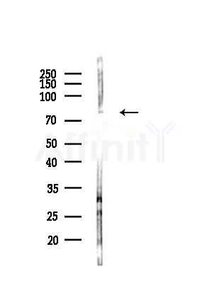 Collagen Type XXIII Antibody - Western blot analysis of lysates from COLO205 cells(UV,30min treatment), using Collagen Type XXIII Antibody at 1/1000 dilution.