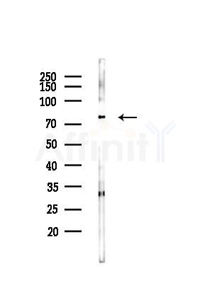 Collagen Type XXIII Antibody - Western blot analysis of lysates from LoVo cells(heat-shock,45min treatment), using Collagen Type XXIII Antibody at 1/1000 dilution.