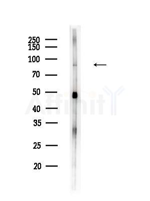 COPG2 Antibody - Western blot analysis of lysates from B16F10-LUC cells(UV,30min treatment), using COPG2 Antibody at 1/1000 dilution.