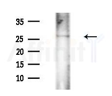 COQ4 Antibody - Western blot analysis of extracts from Rat brain, using COQ4 Antibody at 1/1000 dilution.