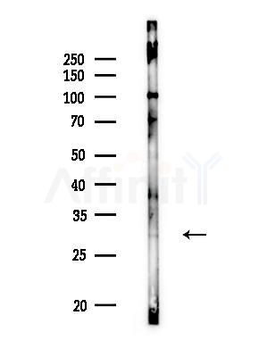 COQ4 Antibody - Western blot analysis of lysates from Rat brain, using COQ4 Antibody at 1/1000 dilution.