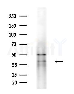COQ5 Antibody - Western blot analysis of extracts from Mouse liver, using COQ5 Antibody at 1/1000 dilution.