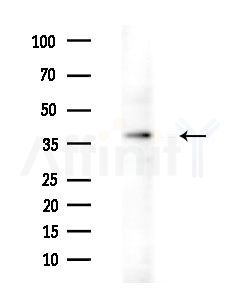 CRISP3 Antibody - Western blot analysis of extracts from HepG2 cells(LPS 4h treatment), using CRISP3 Antibody at 1/1000 dilution.