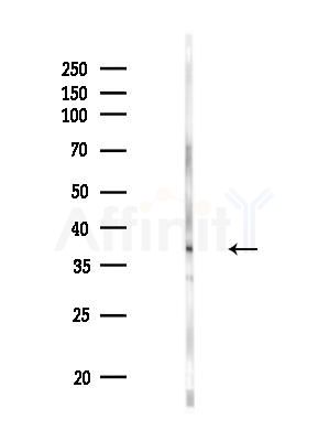 CRISP3 Antibody - Western blot analysis of lysates from HepG2 cells(LPS, 4h treatment), using CRISP3 Antibody at 1/1000 dilution.