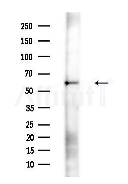 CRMP4 Antibody - Western blot analysis of extracts from Rat brain, using CRMP4 Antibody at 1/1000 dilution.