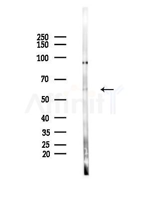Cryptochrome 2 Antibody - Western blot analysis of lysates from HepG2 cells(LPS, 4h treatment), using Cryptochrome 2 Antibody at 1/1000 dilution.