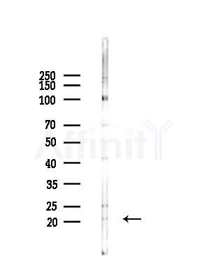 CSRP2 Antibody - Western blot analysis of lysates from LoVo cells(heat-shock,45min treatment), using CSRP2 Antibody at 1/1000 dilution.
