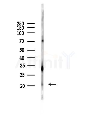 CSRP3 Antibody - Western blot analysis of lysates from PC12 cells, using CSRP3 Antibody at 1/1000 dilution.