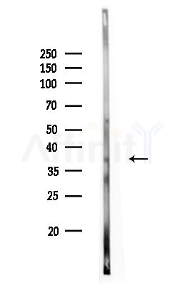 CWC15 Antibody - Western blot analysis of lysates from Rat liver, using CWC15 Antibody at 1/1000 dilution.