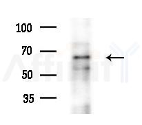 DCP1B Antibody - Western blot analysis of extracts from HepG2 cells(LPS 4h treatment), using DCP1B Antibody at 1/1000 dilution.