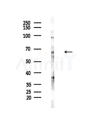 DCP1B Antibody - Western blot analysis of lysates from HepG2 cells(LPS, 4h treatment), using DCP1B Antibody at 1/1000 dilution.