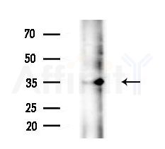 DDRGK1 Antibody - Western blot analysis of extracts from HepG2 cells(LPS 4h treatment), using DDRGK1 Antibody at 1/1000 dilution.