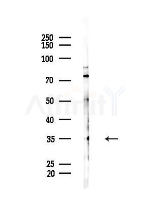 DDRGK1 Antibody - Western blot analysis of lysates from HepG2 cells(LPS, 4h treatment), using DDRGK1 Antibody at 1/1000 dilution.