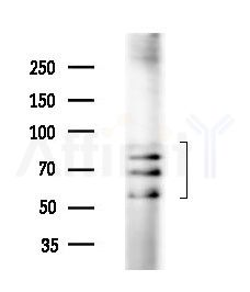 DDX17 Antibody - Western blot analysis of extracts from EC304 cells, using DDX17 Antibody at 1/1000 dilution.