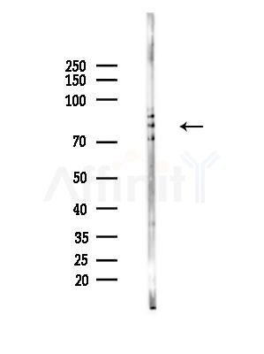 DDX17 Antibody - Western blot analysis of lysates from EC304 cells, using DDX17 Antibody at 1/1000 dilution.
