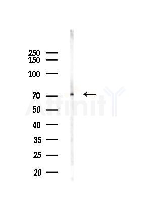 DDX43 Antibody - Western blot analysis of lysates from COLO205 cells(UV,30min treatment), using DDX43 Antibody at 1/1000 dilution.