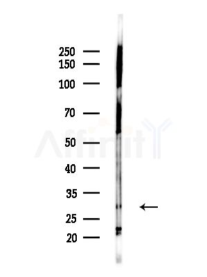 DENR Antibody - Western blot analysis of lysates from LoVo cells(heat-shock,45min treatment), using DENR Antibody at 1/1000 dilution.