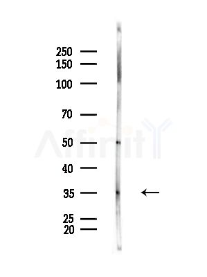 DENR Antibody - Western blot analysis of lysates from Rat brain, using DENR Antibody at 1/1000 dilution.