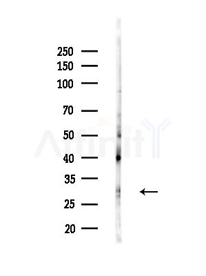 DENR Antibody - Western blot analysis of lysates from B16F10-LUC cells(heat-shock,45min treatment), using DENR Antibody at 1/1000 dilution.