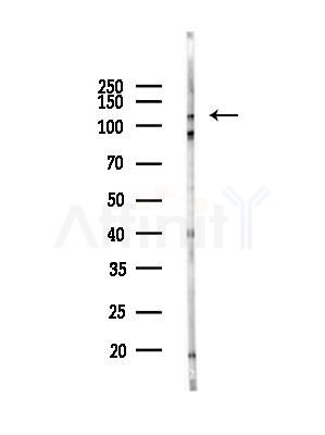 DHX36 Antibody - Western blot analysis of lysates from EC304 cells(heat-shock,45min treatment), using DHX36 Antibody at 1/1000 dilution.