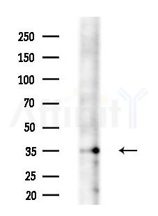 DIO2 Antibody - Western blot analysis of lysates from EC304 cells, using DIO2 Antibody at 1/1000 dilution.