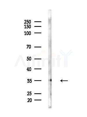 DIO2 Antibody - Western blot analysis of lysates from EC304 cells, using DIO2 Antibody at 1/1000 dilution.