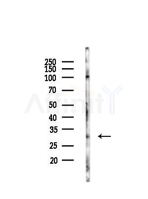 DLEU1 Antibody - Western blot analysis of lysates from Mouse liver, using DLEU1 Antibody at 1/1000 dilution.