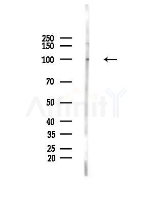 DLGAP3 Antibody - Western blot analysis of lysates from HepG2 cells(LPS, 4h treatment), using DLGAP3 Antibody at 1/1000 dilution.