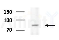 DLL1 Antibody - Western blot analysis of extracts from HepG2 cells(starvation treatment), using DLL1 Antibody at 1/1000 dilution.