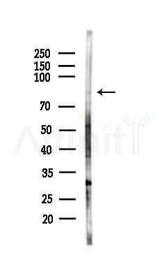 DLL1 Antibody - Western blot analysis of lysates from HepG2 cells(starvation,24h treatment), using DLL1 Antibody at 1/1000 dilution.