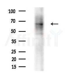 DNAJC11 Antibody - Western blot analysis of extracts from HepG2 cells(LPS 4h treatment), using DNAJC11 Antibody at 1/1000 dilution.
