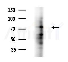 DNAJC21 Antibody - Western blot analysis of extracts from EC304 cells, using DNAJC21 Antibody at 1/1000 dilution.