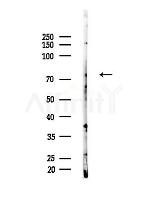 DNAJC21 Antibody - Western blot analysis of lysates from EC304 cells, using DNAJC21 Antibody at 1/1000 dilution.
