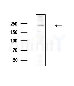 DOCK8 Antibody - Western blot analysis of extracts from HepG2 cells(LPS, 4h treatment), using DOCK8 Antibody at 1/1000 dilution.