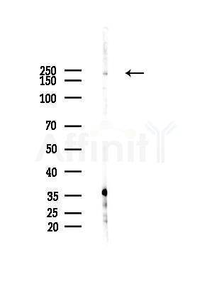DOCK8 Antibody - Western blot analysis of lysates from HepG2 cells(LPS, 4h treatment), using DOCK8 Antibody at 1/1000 dilution.