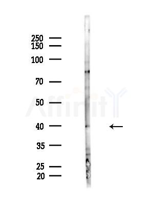 DPEP2 Antibody - Western blot analysis of lysates from HepG2 cells(LPS, 4h treatment), using DPEP2 Antibody at 1/1000 dilution.