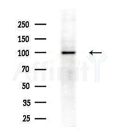 DSE Antibody - Western blot analysis of extracts from HepG2 cells(LPS 4h treatment), using DSE Antibody at 1/1000 dilution.