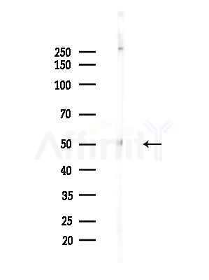 DYNC1LI2 Antibody - Western blot analysis of lysates from LoVo cells(heat-shock,45min treatment), using DYNC1LI2 Antibody at 1/1000 dilution.