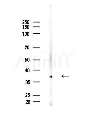 EAF1 Antibody - Western blot analysis of lysates from EC304 cells, using EAF1 Antibody at 1/1000 dilution.