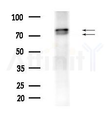 ECD Antibody - Western blot analysis of extracts from HepG2 cells(LPS 4h treatment), using ECD Antibody at 1/1000 dilution.