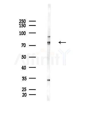 ECD Antibody - Western blot analysis of lysates from HepG2 cells(LPS, 4h treatment), using ECD Antibody at 1/1000 dilution.
