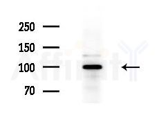 ECE2 Antibody - Western blot analysis of extracts from HepG2 cells(LPS 4h treatment), using ECE2 Antibody at 1/1000 dilution.