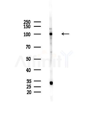 ECE2 Antibody - Western blot analysis of lysates from HepG2 cells(LPS, 4h treatment), using ECE2 Antibody at 1/1000 dilution.