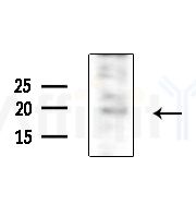 EIF1AX Antibody - Western blot analysis of extracts from HepG2 cells(LPS, 4h treatment), using EIF1AX Antibody at 1/1000 dilution.