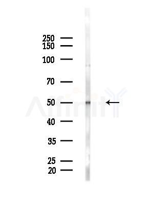 EIF2G/EIF2S3 Antibody - Western blot analysis of lysates from HepG2 cells(LPS, 4h treatment), using EIF2G/EIF2S3 Antibody at 1/1000 dilution.